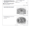 John Deere 844L, 844LAH 4WD Loader Repair Technical Manual