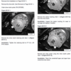 Bobcat 3200 Utility Vehicle Service Repair Manual