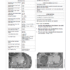 4-39.png John Deere 700L Crawler Dozer Repair Technical Manual (S.N after F383562 – )