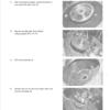 Kawasaki 115ZIII Wheel Loader Service Manual